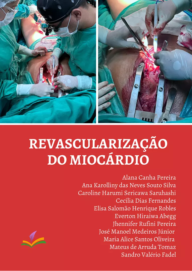 REVASCULARIZAÇÃO DO MIOCÁRDIO